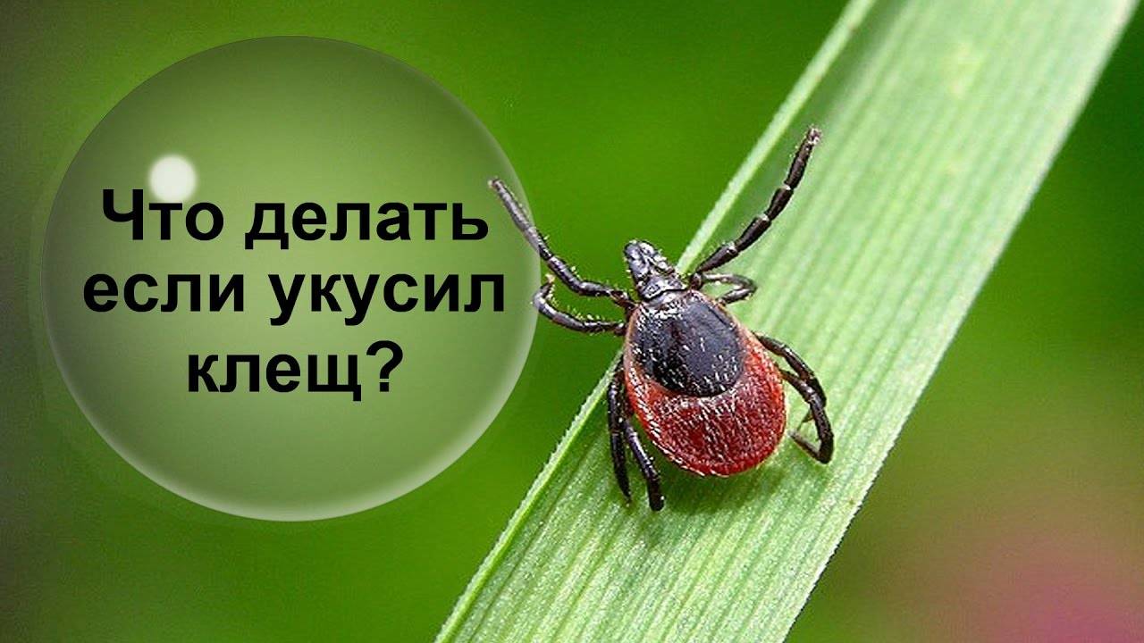 РЕКОМЕНДАЦИИ ГРАЖДАНАМ: Куда обращаться в случае присасывания клещей